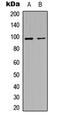 MET Transcriptional Regulator MACC1 antibody, abx121640, Abbexa, Western Blot image 