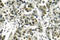 BRCA1 DNA Repair Associated antibody, LS-C175939, Lifespan Biosciences, Immunohistochemistry paraffin image 