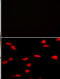 Lysine Methyltransferase 5A antibody, M05349-1, Boster Biological Technology, Immunofluorescence image 