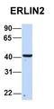 ER Lipid Raft Associated 2 antibody, orb326257, Biorbyt, Western Blot image 