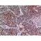Interleukin 13 Receptor Subunit Alpha 2 antibody, LS-C387702, Lifespan Biosciences, Immunohistochemistry frozen image 