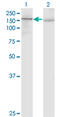 Platelet Derived Growth Factor Receptor Alpha antibody, LS-C197864, Lifespan Biosciences, Western Blot image 