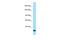 SLIT-ROBO Rho GTPase Activating Protein 3 antibody, A06020, Boster Biological Technology, Western Blot image 