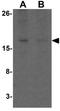 Coiled-Coil-Helix-Coiled-Coil-Helix Domain Containing 7 antibody, GTX32101, GeneTex, Western Blot image 