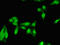 Nuclear Prelamin A Recognition Factor antibody, orb52783, Biorbyt, Immunofluorescence image 