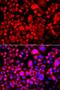 FAS antibody, LS-B16463, Lifespan Biosciences, Immunofluorescence image 