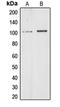 Chromodomain Helicase DNA Binding Protein 1 Like antibody, orb214911, Biorbyt, Western Blot image 