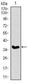 Integrin Subunit Alpha 2b antibody, NBP2-37384, Novus Biologicals, Western Blot image 