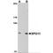 SPG11 Vesicle Trafficking Associated, Spatacsin antibody, MBS150871, MyBioSource, Western Blot image 