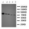 Tyrosine-protein kinase Tec antibody, orb137879, Biorbyt, Western Blot image 