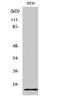 Synuclein Gamma antibody, STJ95864, St John