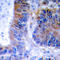 TNF Alpha Induced Protein 1 antibody, LS-C354104, Lifespan Biosciences, Immunohistochemistry paraffin image 