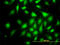 Rap guanine nucleotide exchange factor 6 antibody, LS-B6348, Lifespan Biosciences, Immunofluorescence image 