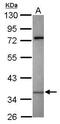 Killer Cell Immunoglobulin Like Receptor, Two Ig Domains And Short Cytoplasmic Tail 2 antibody, GTX119432, GeneTex, Western Blot image 