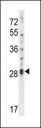 Interleukin 17D antibody, LS-C165177, Lifespan Biosciences, Western Blot image 