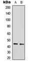 Sirtuin 2 antibody, LS-C358861, Lifespan Biosciences, Western Blot image 