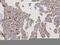 Glycophorin A (MNS Blood Group) antibody, A02184-2, Boster Biological Technology, Immunohistochemistry paraffin image 