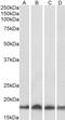 Ubiquitin Conjugating Enzyme E2 L3 antibody, LS-C20223, Lifespan Biosciences, Western Blot image 