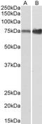 T-complex protein 1 subunit gamma antibody, 42-011, ProSci, Western Blot image 