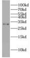 SLX1 Homolog B, Structure-Specific Endonuclease Subunit antibody, FNab03466, FineTest, Western Blot image 
