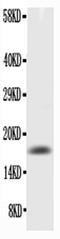 Colony Stimulating Factor 2 antibody, PA5-79075, Invitrogen Antibodies, Western Blot image 