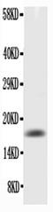 Colony Stimulating Factor 2 antibody, PA5-79075, Invitrogen Antibodies, Western Blot image 