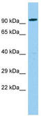 Centrosomal Protein 85 Like antibody, TA332230, Origene, Western Blot image 