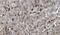 Vitronectin antibody, GTX60980, GeneTex, Immunohistochemistry paraffin image 