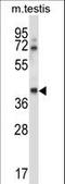 Casein Kinase 1 Gamma 1 antibody, LS-C164355, Lifespan Biosciences, Western Blot image 