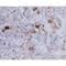 CD209 antigen antibody, MA5-15746, Invitrogen Antibodies, Immunohistochemistry frozen image 