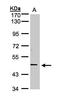TNF Receptor Superfamily Member 25 antibody, LS-B4838, Lifespan Biosciences, Western Blot image 