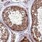 Protein cereblon antibody, PA5-61122, Invitrogen Antibodies, Immunohistochemistry paraffin image 