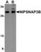 Nipsnap Homolog 3B antibody, TA306697, Origene, Western Blot image 