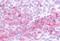 C-C Motif Chemokine Receptor 9 antibody, GTX13313, GeneTex, Immunohistochemistry paraffin image 