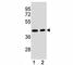 Adenosine Deaminase antibody, F40390-0.4ML, NSJ Bioreagents, Western Blot image 