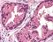 Thymidine Kinase 1 antibody, 48-980, ProSci, Immunohistochemistry paraffin image 