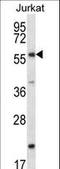 Forkhead Box J3 antibody, LS-C159674, Lifespan Biosciences, Western Blot image 