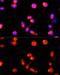 ATP Binding Cassette Subfamily A Member 4 antibody, GTX65907, GeneTex, Immunocytochemistry image 