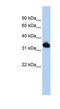 Galactose Mutarotase antibody, NBP1-56713, Novus Biologicals, Western Blot image 