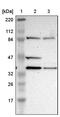 DSN1 Component Of MIS12 Kinetochore Complex antibody, PA5-51742, Invitrogen Antibodies, Western Blot image 