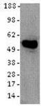 Keratin 8 antibody, 14-9938-82, Invitrogen Antibodies, Western Blot image 