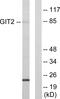 GIT ArfGAP 2 antibody, LS-C119035, Lifespan Biosciences, Western Blot image 