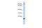 Mitochondrial Ribosomal Protein L58 antibody, A08349, Boster Biological Technology, Western Blot image 