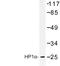 Chromobox 5 antibody, LS-C176766, Lifespan Biosciences, Western Blot image 