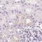 Insulin Like Growth Factor Binding Protein 1 antibody, PA5-62226, Invitrogen Antibodies, Immunohistochemistry paraffin image 