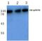 Cbl Proto-Oncogene antibody, PA5-36735, Invitrogen Antibodies, Western Blot image 