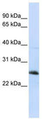 Reticulon 1 antibody, TA338454, Origene, Western Blot image 