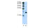 Recoverin antibody, 28-817, ProSci, Western Blot image 