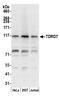 Tudor Domain Containing 7 antibody, A305-126A, Bethyl Labs, Western Blot image 