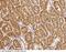 Pumilio RNA Binding Family Member 2 antibody, 100633-T08, Sino Biological, Immunohistochemistry paraffin image 